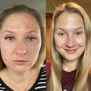 Best Vitamin C Serum - Monat C Radiance